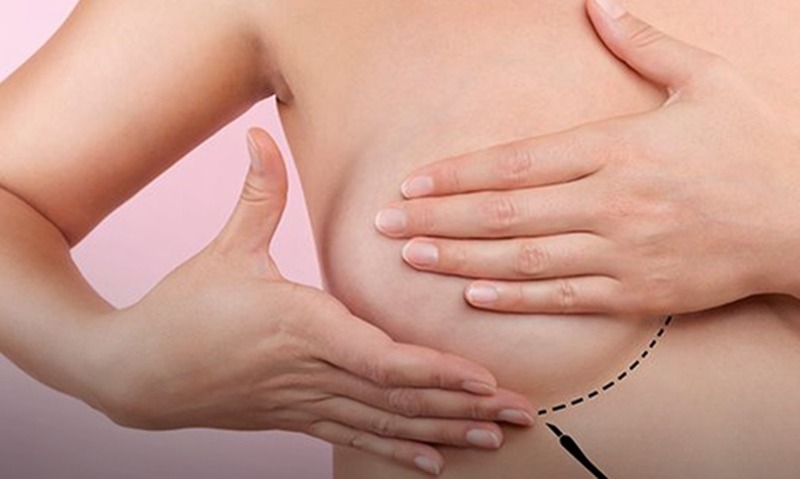 Outubro Rosa: diagnóstico precoce do câncer de mama aumenta em 95% as chances de cura