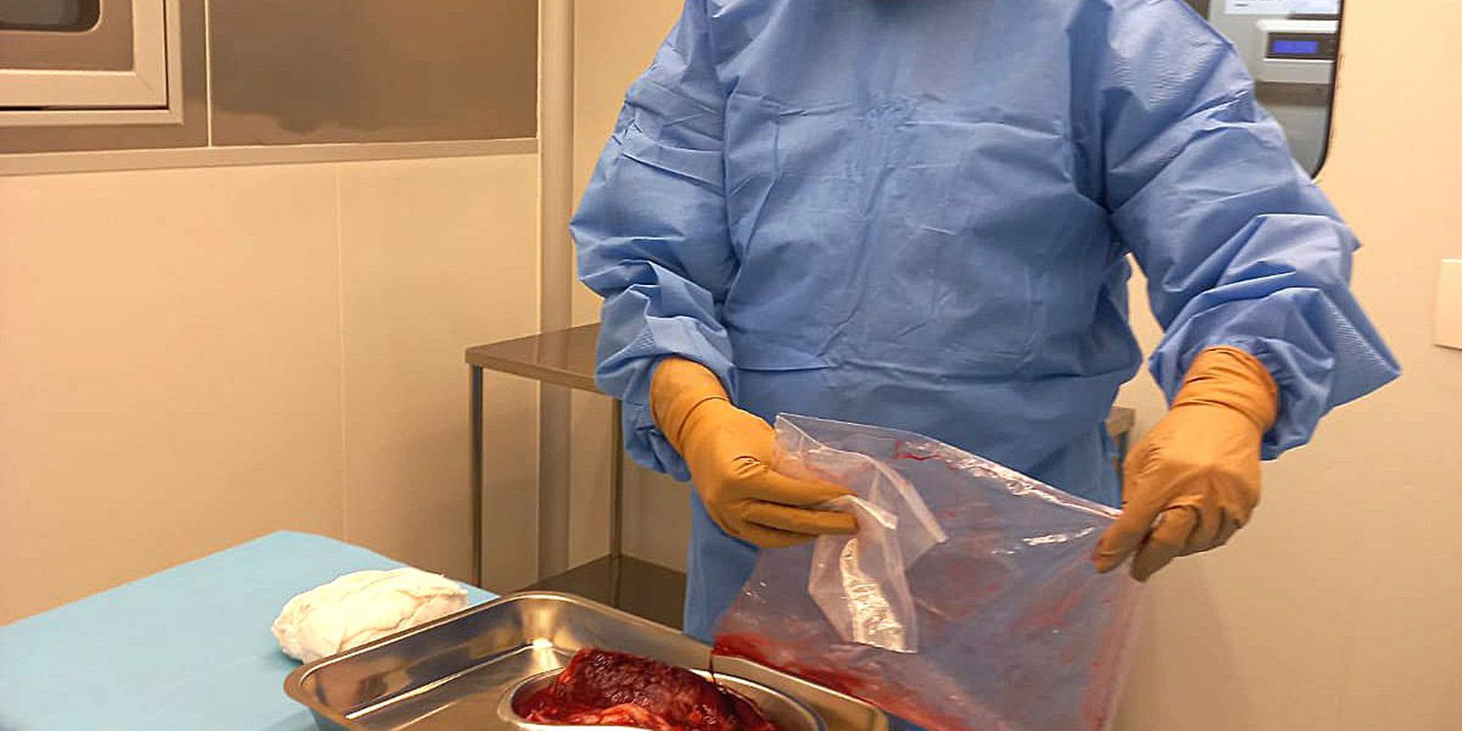 Pesquisa desenvolve curativos biológicos à base de placenta